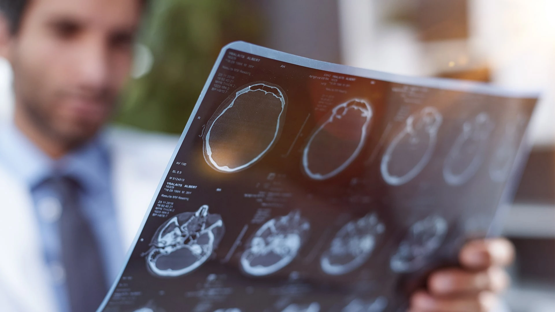 Акции CNS Pharmaceutical, которая разрабатывает лекарства от рака головного мозга, продолжают пике / Фото: Shutterstock