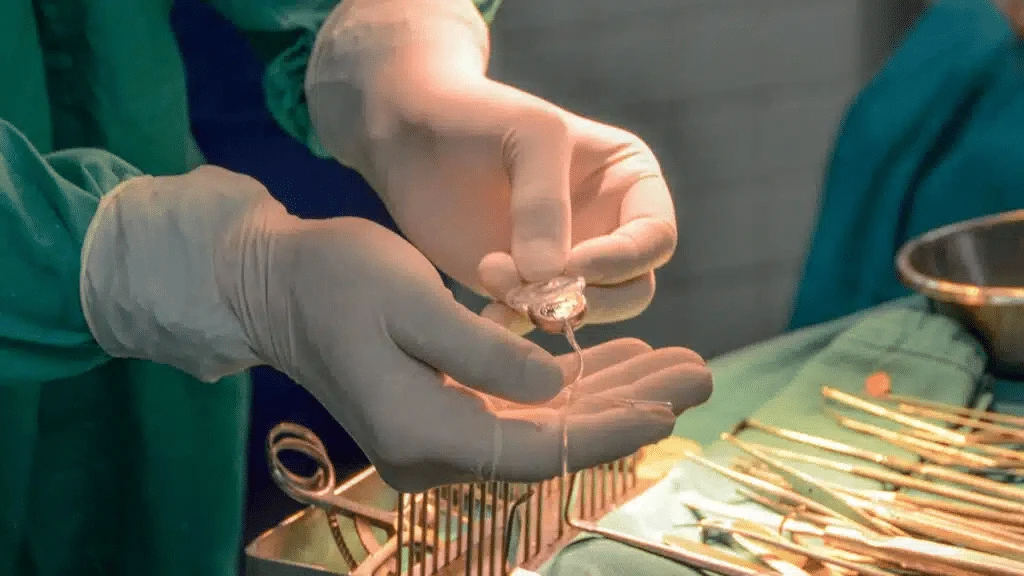 A U.S. Senate bill could make Envoy Medical hearing implants covered by Medicare  / Photo: Envoy Medical