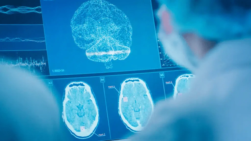 Denmark’s Lundbeck is acquiring Longboard to strengthen its position in the brain health market / Photo: Shutterstock