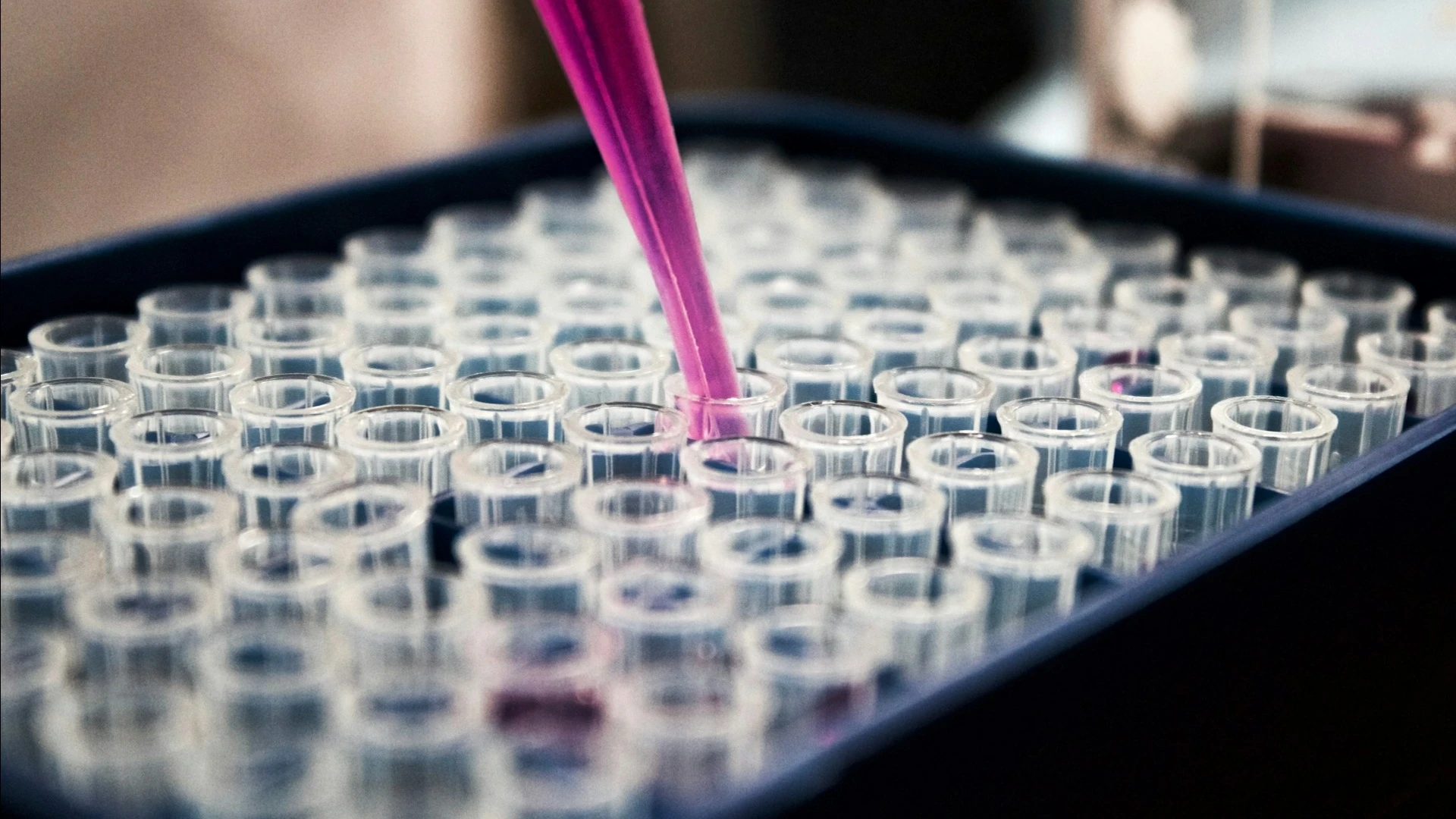 Organovo is selling its inflammatory bowel disease drug program to pharma giant Eli Lilly. / Photo: Unsplash/Louis Reed