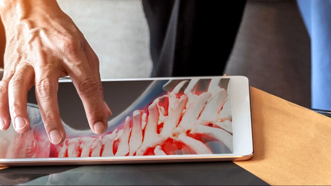 Разработчик технологии регенерации костей Bone Biologics нацелился на рынок объемом $3 млрд / Фото: Bonebiologics.com