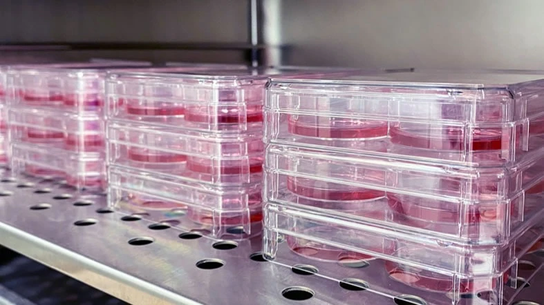 У ProKidney все еще нет четкой договоренности с регулятором о пути получения лицензии на продажу лекарства от почечной недостаточности, отмечают аналитики / Фото: ProKidney