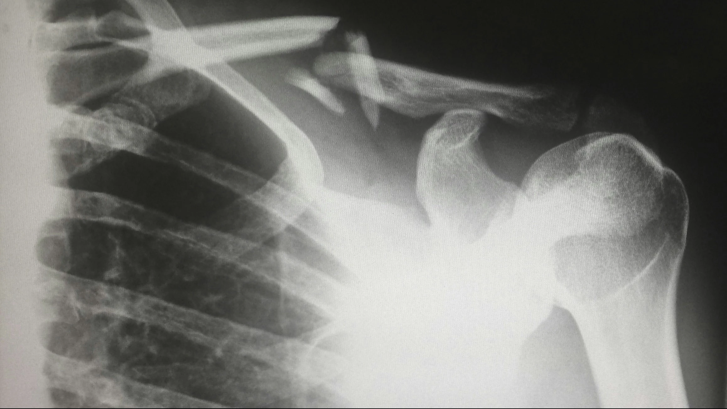 Shoulder Innovations привлекла $100 млн на IPO / Фото: Harlie Raethel / Unsplash