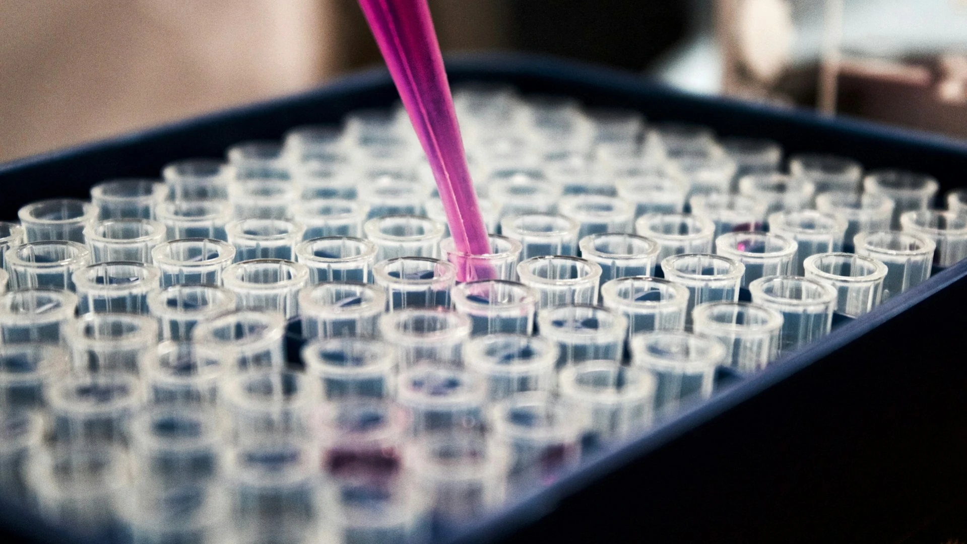 Freedom посоветовал покупать акции разработчика препарата от облысения / Фото: Unsplash / Louis Reed